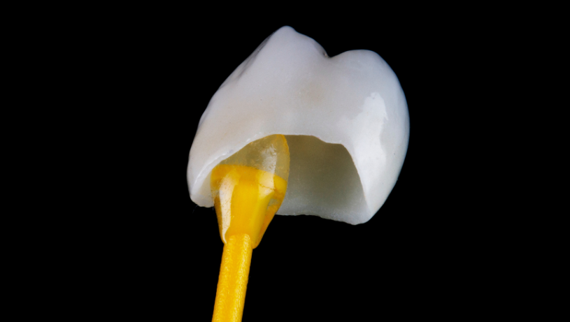 Protetika1-KosGrabarDental