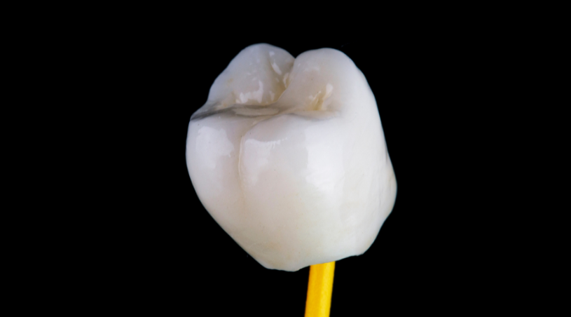 Protetika2-KosGrabarDental