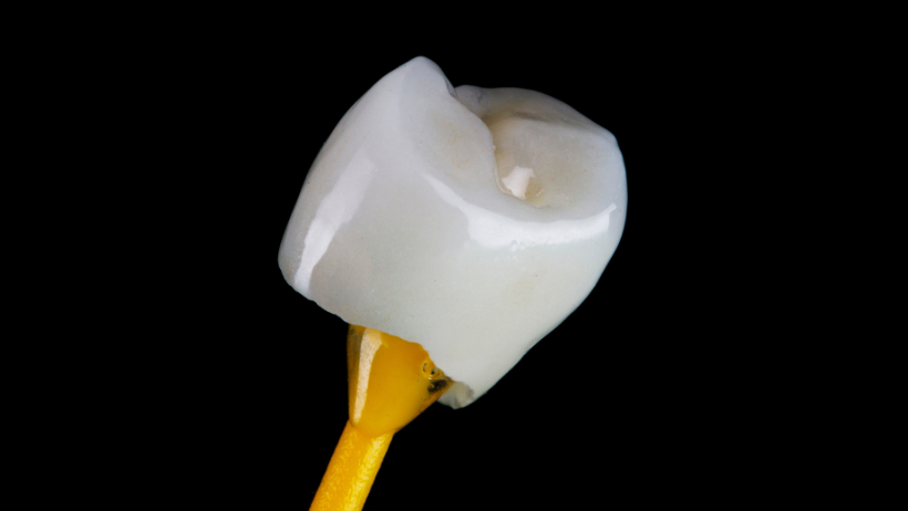 Protetika3-KosGrabarDental